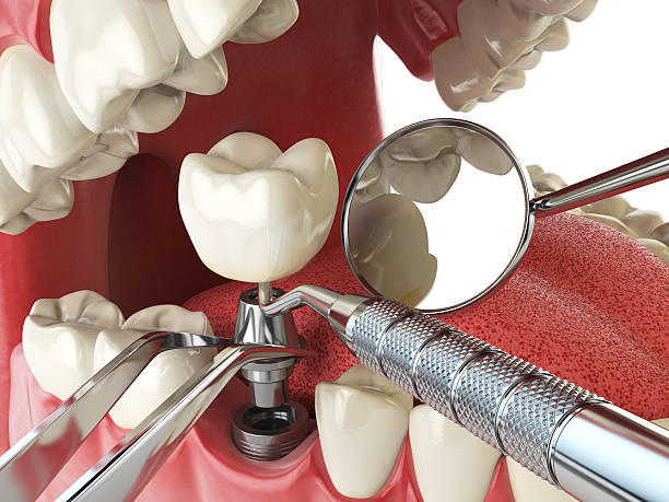 Best Emergency Dental Surgery in South Jacksonvle, IL